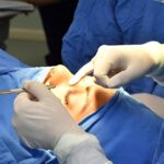 Advierte Salud Colima sobre riesgos para padecer glaucoma; ofrece servicio gratuito de oftalmología